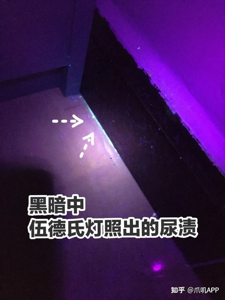 尿异常红细胞形态检查标准值_尿异常_尿异常红细胞高为什么