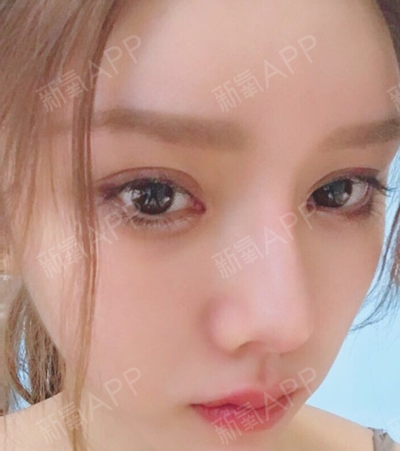 游戏整容日记攻略_整容日记攻略游戏在线观看_整容日记攻略游戏