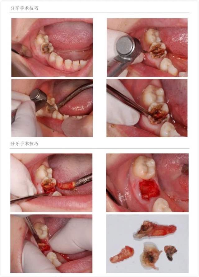 拔牙医院挂什么科_拔牙医院_拔牙医院可以报销吗