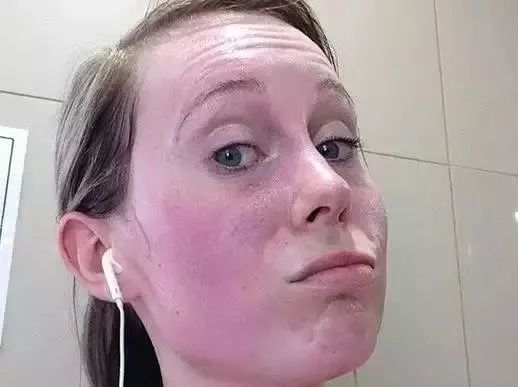 玩手机游戏脸红_玩游戏脸红_玩手机脸红怎么办