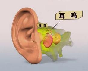 泡泡大作战游戏手机游戏 