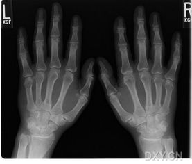 手掌模拟器联机版下载 